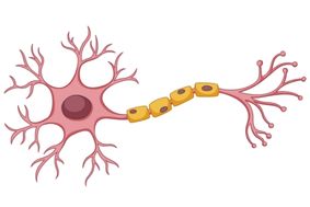 Diagnosis of Multiple Sclerosis in udaipur