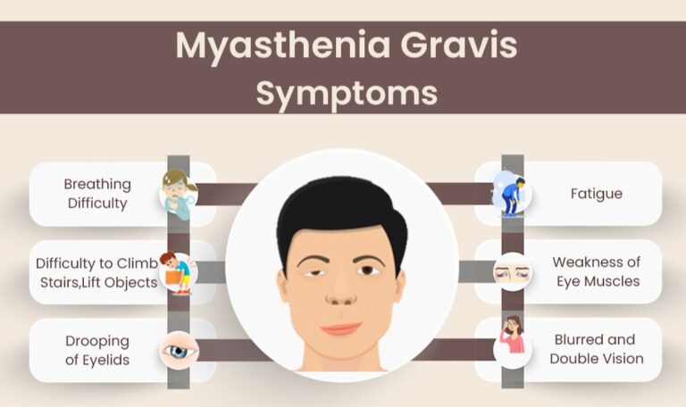 Myasthenia Gravis Problem