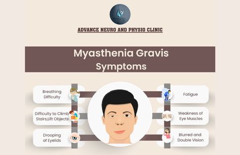 Symptoms of Myasthenia Gravis